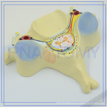 PNT-0615 melhor preço do modelo de osso de implante para venda